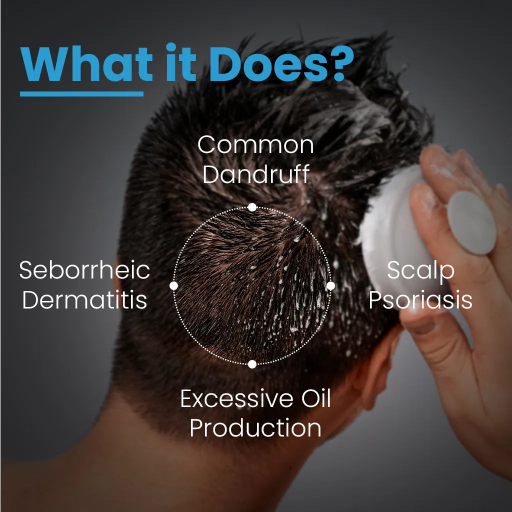 T-Shampoo Anti-Dandruff — Calm the Scalp, Stop the Flakes